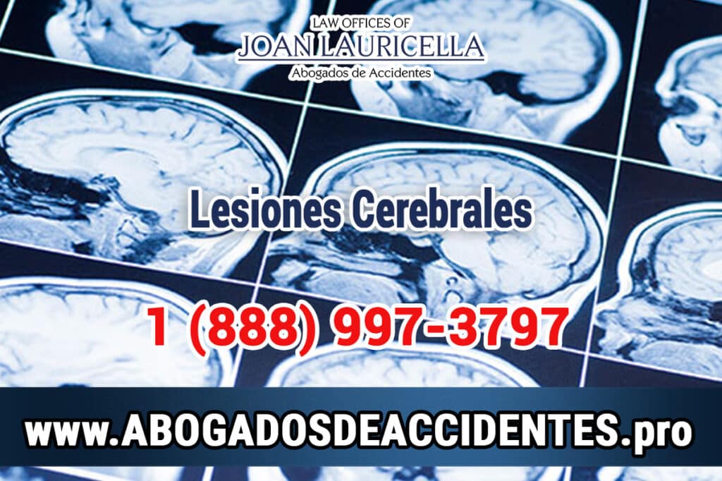 Abogados de Accidentes de Motocicleta en Los Angeles